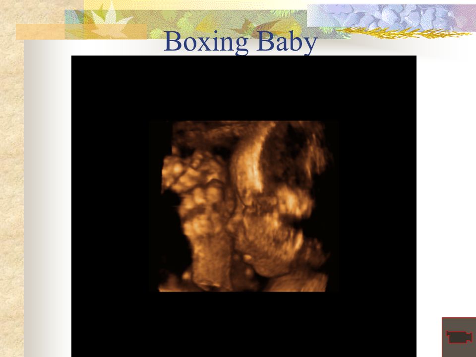 Boxing Baby