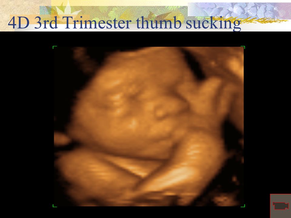 4D 3rd Trimester thumb sucking