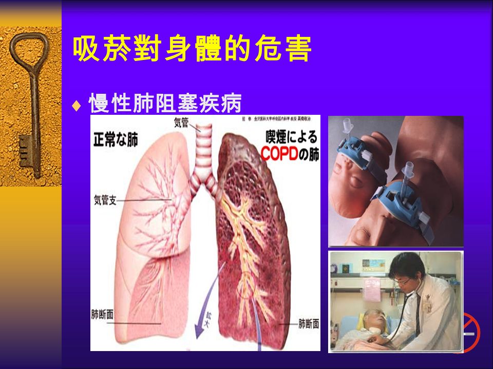 吸菸對身體的危害  慢性肺阻塞疾病