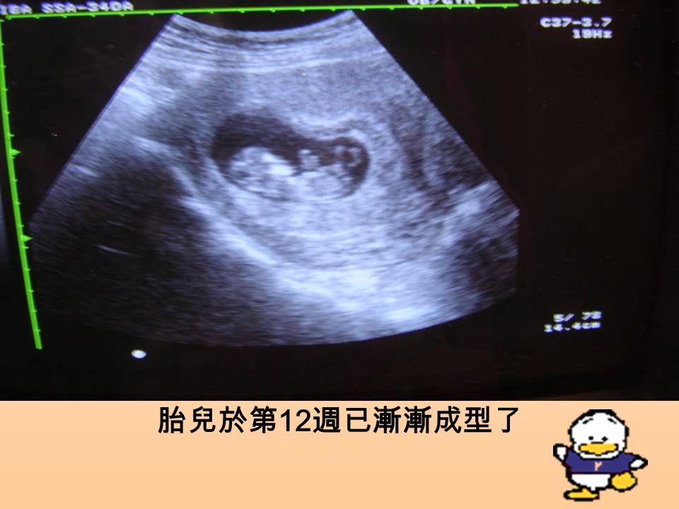 胎兒於第 12 週已漸漸成型了