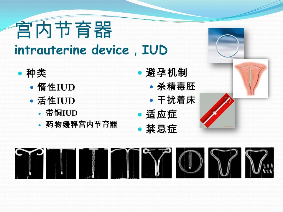 宫内节育器 intrauterine device ， IUD 种类 惰性 IUD 活性 IUD 带铜 IUD 药物缓释宫内节育器 避孕机制 杀精毒胚 干扰着床 适应症 禁忌症