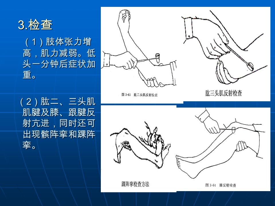 方法髌阵挛和踝阵挛踝阵挛阳性髌阵挛图片踝阵挛的检查方法及阳性意义