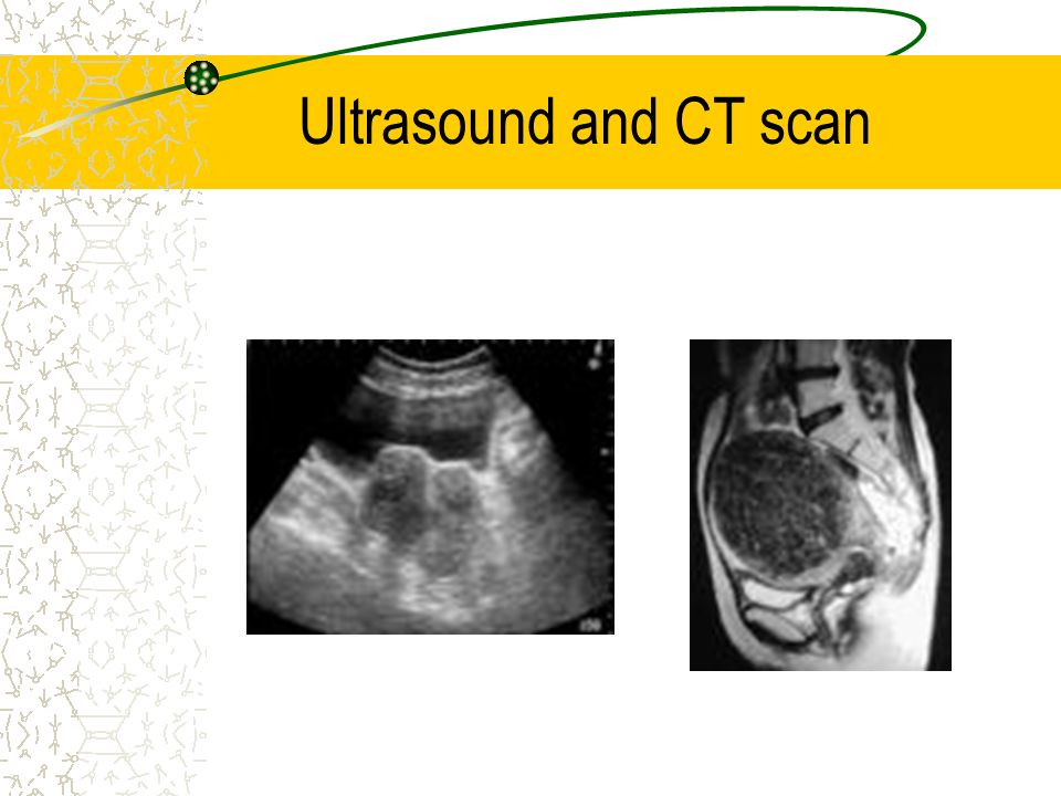 Ultrasound and CT scan