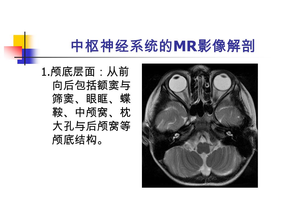 中枢神经系统的 MR 影像解剖 1. 颅底层面：从前 向后包括额窦与 筛窦、眼眶、蝶 鞍、中颅窝、枕 大孔与后颅窝等 颅底结构。