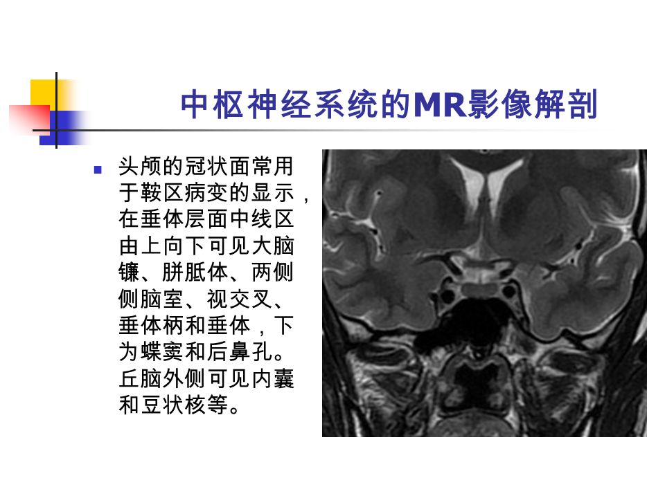 中枢神经系统的 MR 影像解剖 头颅的冠状面常用 于鞍区病变的显示， 在垂体层面中线区 由上向下可见大脑 镰、胼胝体、两侧 侧脑室、视交叉、 垂体柄和垂体，下 为蝶窦和后鼻孔。 丘脑外侧可见内囊 和豆状核等。