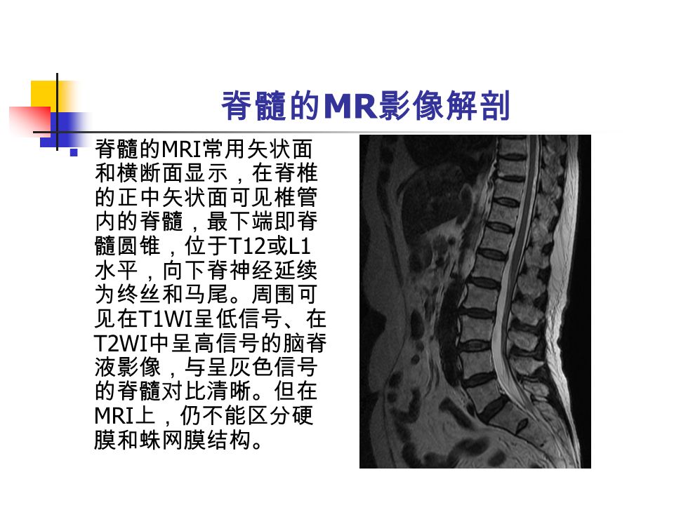 脊髓的 MR 影像解剖 脊髓的 MRI 常用矢状面 和横断面显示，在脊椎 的正中矢状面可见椎管 内的脊髓，最下端即脊 髓圆锥，位于 T12 或 L1 水平，向下脊神经延续 为终丝和马尾。周围可 见在 T1WI 呈低信号、在 T2WI 中呈高信号的脑脊 液影像，与呈灰色信号 的脊髓对比清晰。但在 MRI 上，仍不能区分硬 膜和蛛网膜结构。