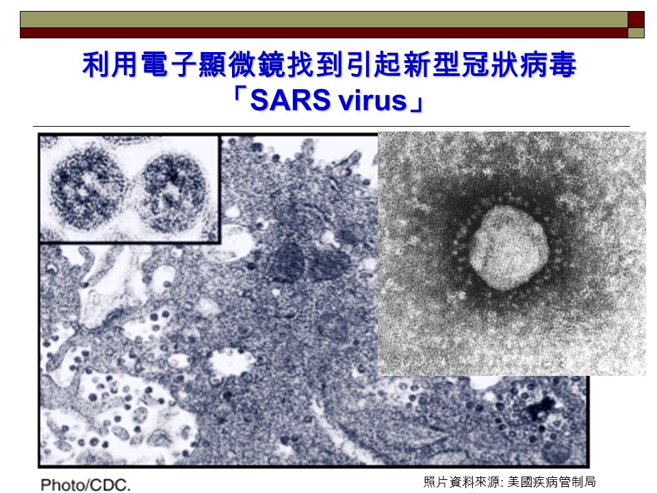 利用電子顯微鏡找到引起新型冠狀病毒 「 SARS virus 」 照片資料來源 : 美國疾病管制局