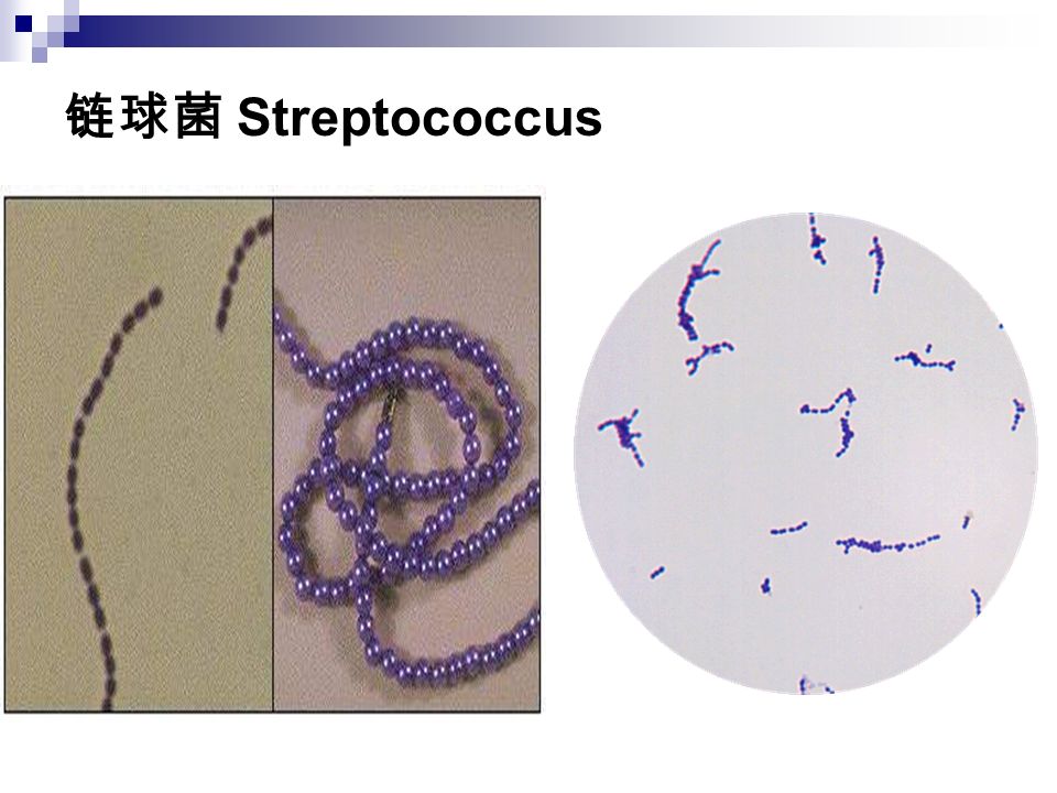 链球菌 Streptococcus