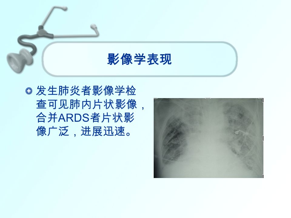 影像学表现 发生肺炎者影像学检 查可见肺内片状影像， 合并 ARDS 者片状影 像广泛，进展迅速。