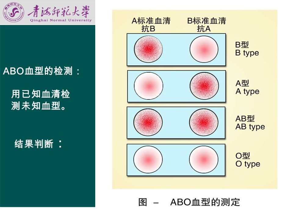 第五节 血型与输血原则 一、人类的血型 二、 ABO 血型 分型依据和种类 红细胞凝集