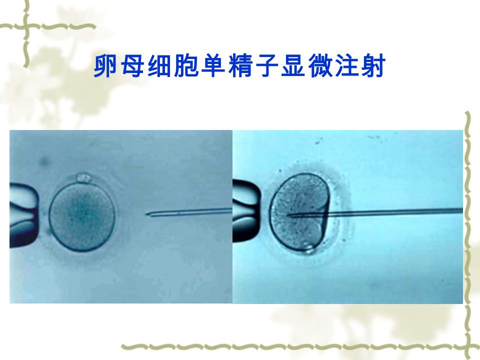 卵母细胞单精子显微注射