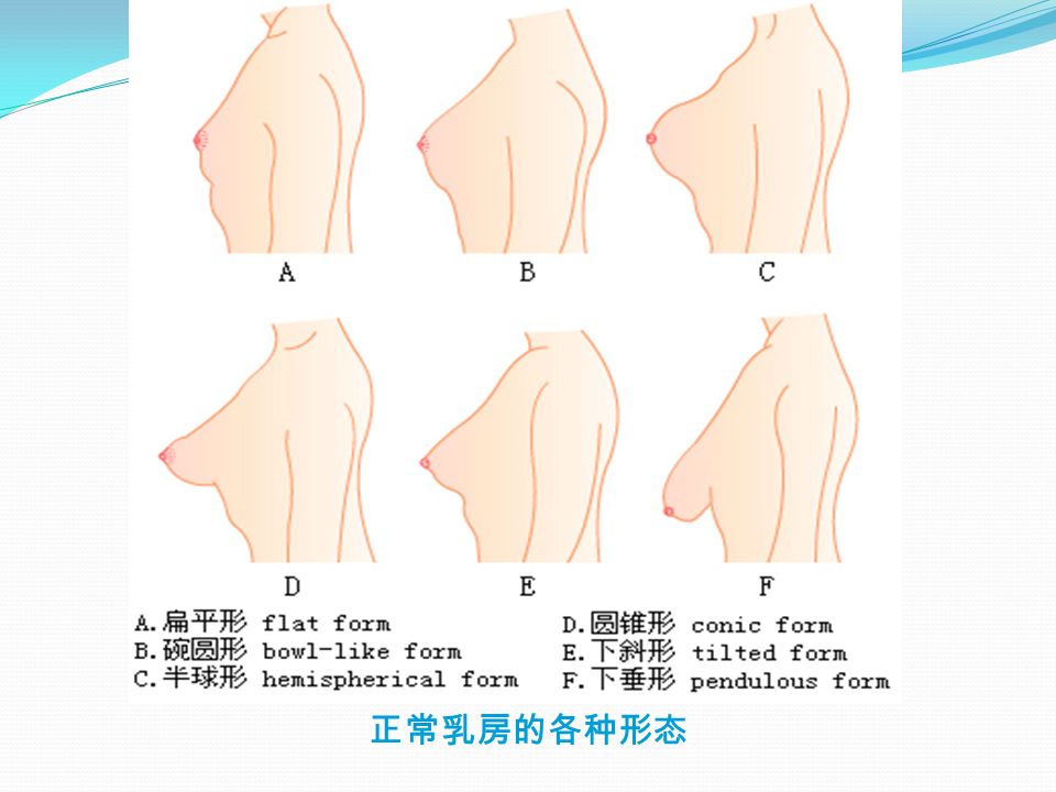 正常乳房的各种形态