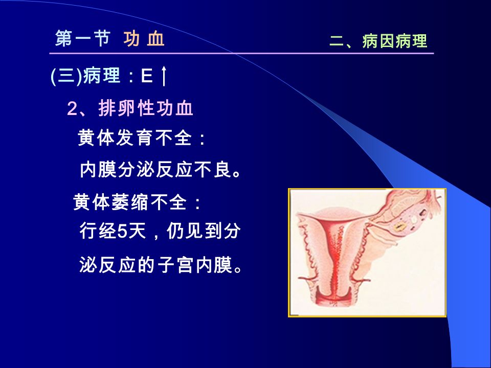 2 、排卵性功血 黄体发育不全： 黄体萎缩不全： 第一节 功 血 二、病因病理 ( 三 ) 病理： E 行经 5 天，仍见到分 泌反应的子宫内膜。 内膜分泌反应不良。