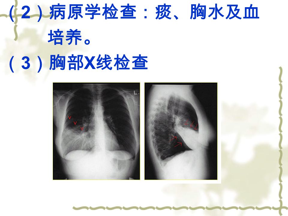 （ 2 ）病原学检查：痰、胸水及血 培养。 （ 3 ）胸部 X 线检查