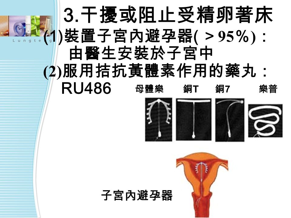 子宮內避孕器 母體樂銅T銅T 銅7銅7 樂普 3. 干擾或阻止受精卵著床 (1) 裝置子宮內避孕器 ( ＞ 95 ％ ) ： 由醫生安裝於子宮中 (2) 服用拮抗黃體素作用的藥丸： RU486