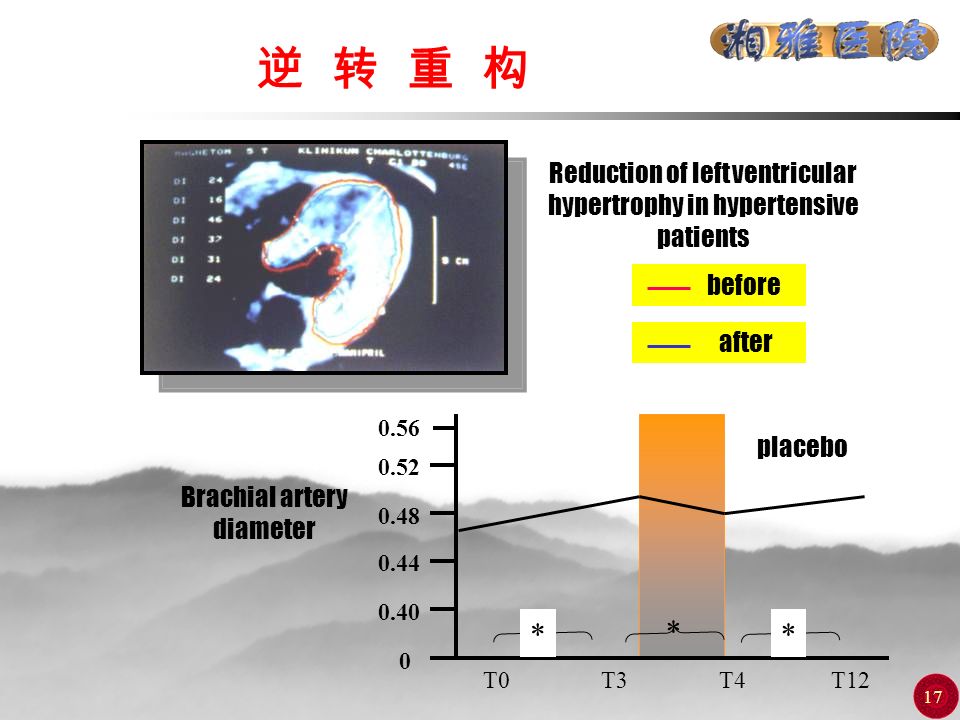 17 逆 转 重 构 T0T12T4T3 Brachial artery diameter Reduction of left ventricular hypertrophy in hypertensive patients before after placebo * * *