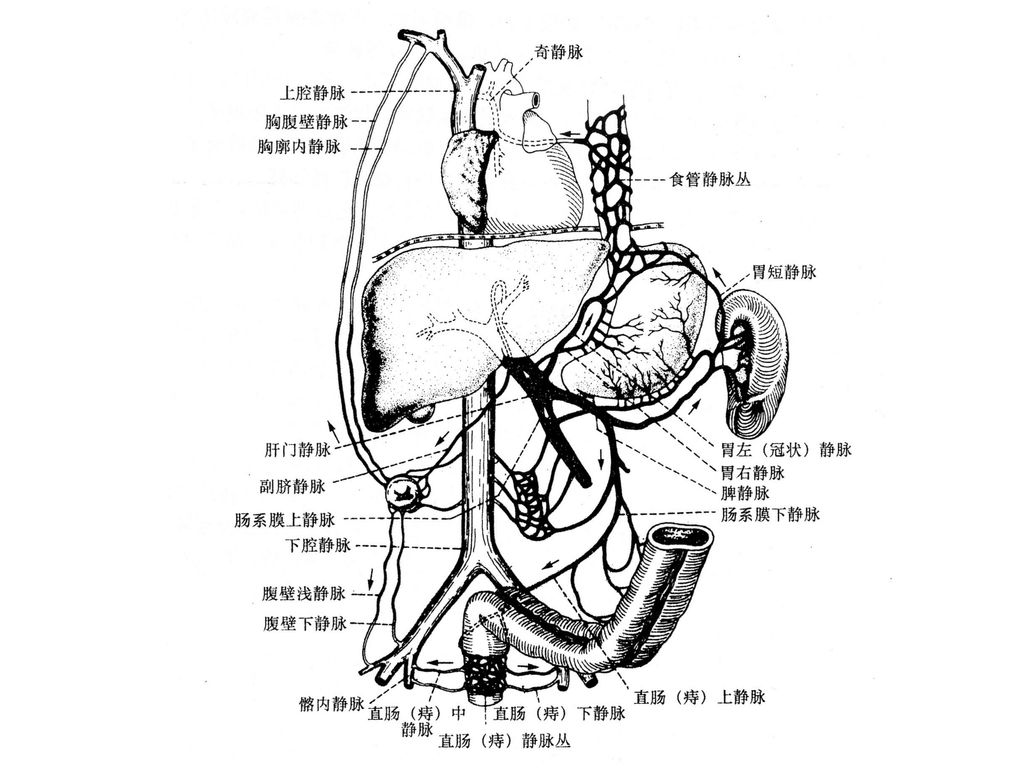 肝硬化解剖图图片